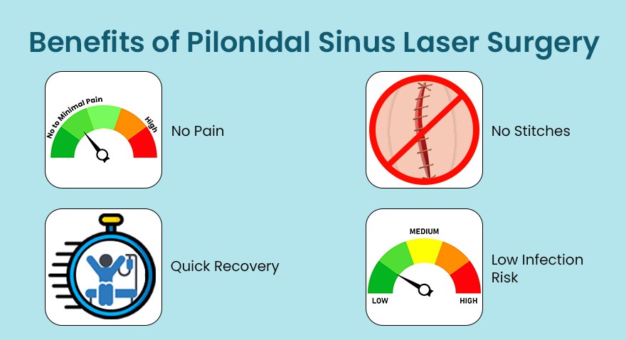 Benefits of Pilonidal Sinus Laser Surgery